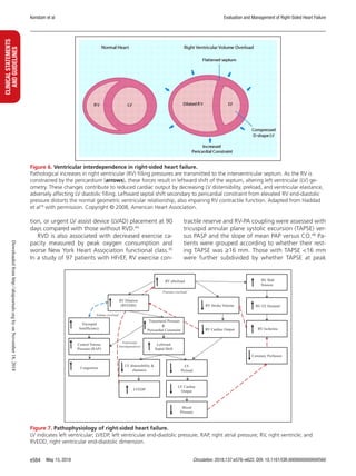 2018 evaluation and management of right sided heart failure | PDF