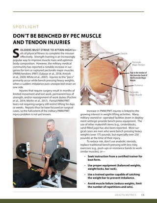 HEALTH METRICS 13
DON’T BE BENCHED BY PEC MUSCLE
AND TENDON INJURIES
S P O T L I G H T
S
OLDIERS MUST STRIVE TO ATTAIN HIGH lev-
els of physical fitness to complete the mission
effectively. Strength training is an increasingly
popular way to improve muscle mass and optimize
body composition. However, the military medical
community has reported a notable increase in sur-
geries for torn or ruptured pectoralis major muscles
(PMM)/tendons (PMT) (Salazar et al., 2018; Antosh
et al., 2009; White et al., 2007). Injuries to the “pecs”
primarily occur while bench pressing heavy weights,
when a sudden imbalance puts unexpected strain on
one side.
	 Injuries that require surgery result in months of
limited movement and lost work, permanent loss of
strength, and/or reassignment of work duties (Pochini
et al., 2014; Merlin et al., 2017). Partial PMM/PMT
tears not requiring surgery still restrict lifting for days
or weeks. Reports thus far have focused on surgical
cases, so the full extent of the military PMM/PMT
injury problem is not yet known.
	 Increase in PMM/PMT injuries is linked to the
growing interest in weight-lifting activities. Many
military-owned or -operated facilities (even in deploy-
ment settings) provide bench press equipment. The
use of other makeshift items (e.g., cinderblocks,
sand-filled jugs) has also been reported. Most sur-
gical cases are men who were bench pressing heavy
weights (over 175 pounds, but especially over 250
pounds) at the time of their injury.
	 To reduce risk, don’t use anabolic steroids,
replace traditional bench pressing with less risky
exercises (e.g., push-ups or resistance bands to work
similar muscles), or—
•	 Seek instruction from a certified trainer for
best form.
•	 Use proper equipment (balanced weights,
weight locks, bar rack).
•	 Use a trained spotter capable of catching
the weight bar to prevent imbalance.
•	 Avoid muscle failure (reduce weights, limit
the number of repetitions and sets).
Upper Sternum Clavicle
Pectoralis
Major Tendon
Humerus
Pectoralis
Major Muscle
Tear in the tendon of
the clavicular head of
the Pectoralis Major
Muscle
 
