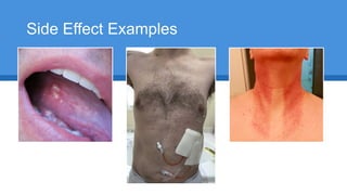 Side Effect Examples
 