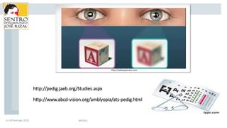 http://pedig.jaeb.org/Studies.aspx
http://www.abcd-vision.org/amblyopia/ats-pedig.html
#PEDIG(c) APSantiago 2018
http://ta...