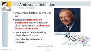 Amblyopia Definition
Gunter K von Noorden
• Unilateral or bilateral decrease in
VA
• caused by pattern vision
deprivation ...