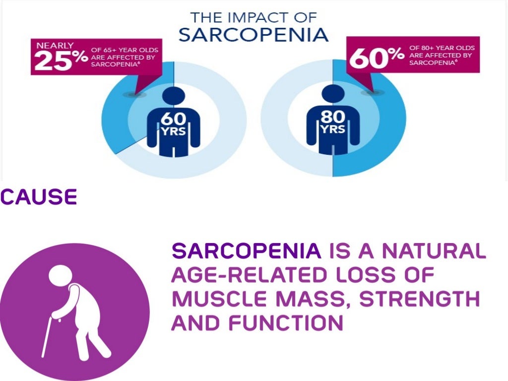 Optimizing Medical Nutrition Therapy in sarcopenia of Elderly patien…