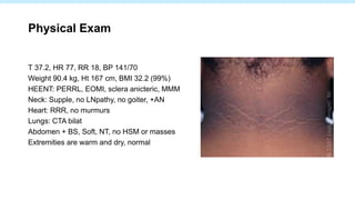 Physical Exam
T 37.2, HR 77, RR 18, BP 141/70
Weight 90.4 kg, Ht 167 cm, BMI 32.2 (99%)
HEENT: PERRL, EOMI, sclera anicteric, MMM
Neck: Supple, no LNpathy, no goiter, +AN
Heart: RRR, no murmurs
Lungs: CTA bilat
Abdomen + BS, Soft, NT, no HSM or masses
Extremities are warm and dry, normal
 
