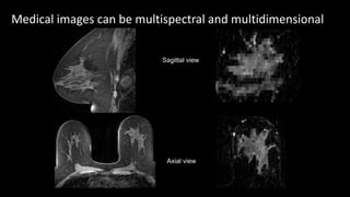 Medical images can be multispectral and multidimensional
Sagittal view
Axial view
 