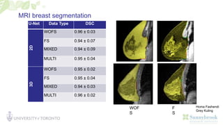 MRI breast segmentation
U-Net Data Type DSC
2D WOFS 0.96 ± 0.03
FS 0.94 ± 0.07
MIXED 0.94 ± 0.09
MULTI 0.95 ± 0.04
3D
WOFS 0.95 ± 0.02
FS 0.95 ± 0.04
MIXED 0.94 ± 0.03
MULTI 0.96 ± 0.02
WOF
S
F
S
Homa Fashendi
Grey Kuling
 