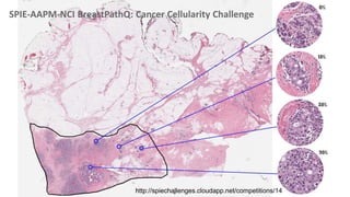 SPIE-AAPM-NCI BreastPathQ: Cancer Cellularity Challenge
http://spiechallenges.cloudapp.net/competitions/14
 