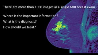There are more than 1500 images in a single MRI breast exam.
Where is the important information?
What is the diagnosis?
How should we treat?
 