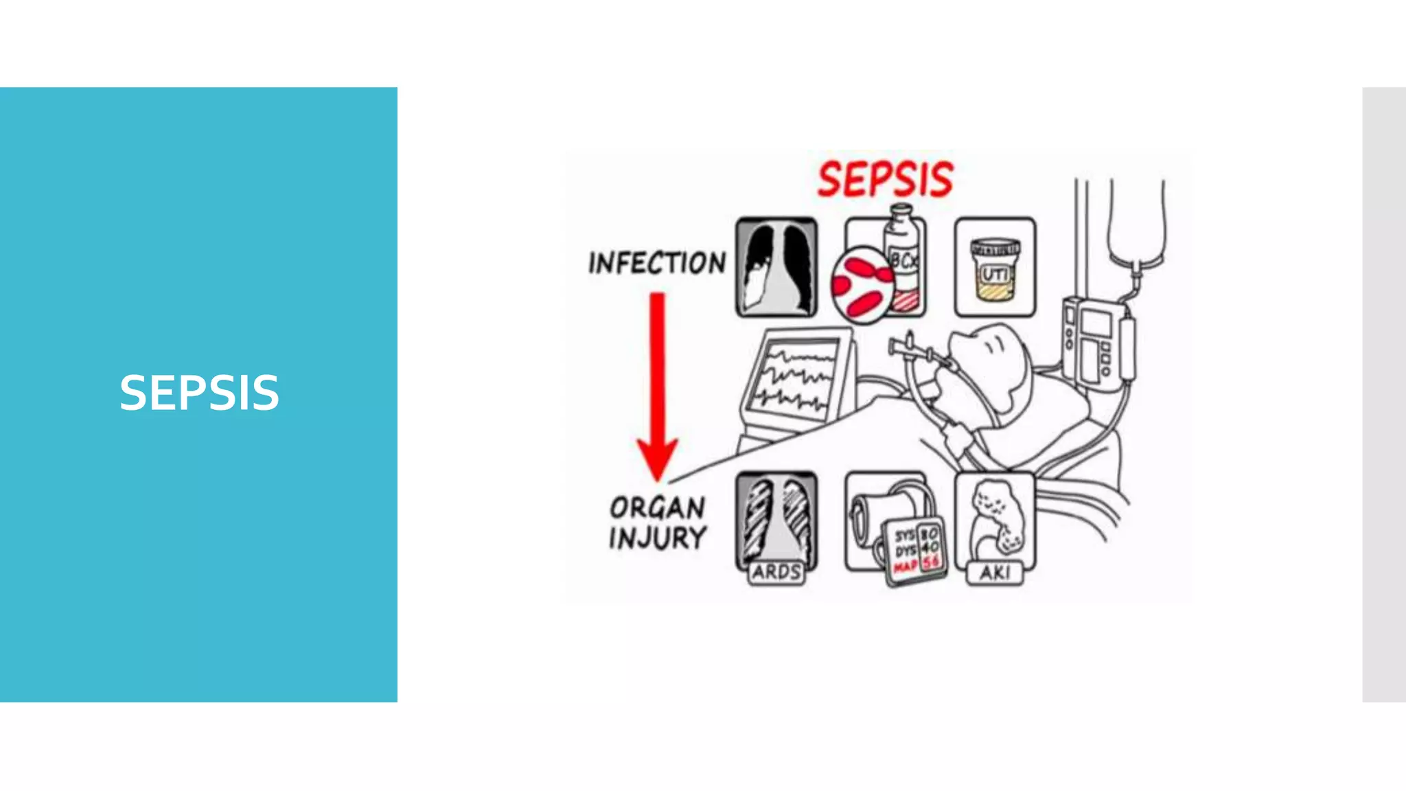 SEPSIS
 