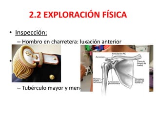 2.2 EXPLORACIÓN FÍSICA
• Inspección:
– Hombro en charretera: luxación anterior
• Palpación:
– Clavícula
– Acromion
– Tubérculo mayor y menor
 
