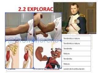 2.2 EXPLORACIÓN FÍSICA
• Movilidad:
 