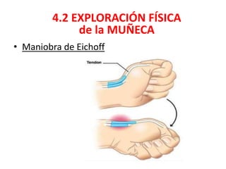 • Maniobra de Eichoff
4.2 EXPLORACIÓN FÍSICA
de la MUÑECA
 