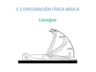 5.2 EXPLORACIÓN FÍSICA BÁSICA
Lassegue
 