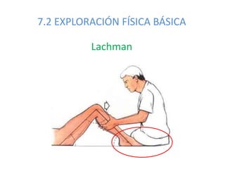 7.2 EXPLORACIÓN FÍSICA BÁSICA
Lachman
 
