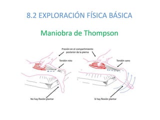8.2 EXPLORACIÓN FÍSICA BÁSICA
Maniobra de Thompson
 