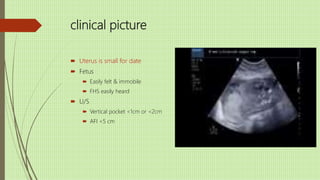 clinical picture
 Uterus is small for date
 Fetus
 Easily felt & immobile
 FHS easily heard
 U/S
 Vertical pocket <1cm or <2cm
 AFI <5 cm
 