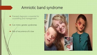 Amniotic band syndrome
 Prenatal diagnosis is essential for
counselling and management
 Can mimic genetic syndromes
 Risk of recurrence of is low
 