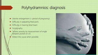 Polyhydramnios: diagnosis
 Uterine enlargement (> period of pregnancy)
 Difficulty in palpating fetal parts
 Difficulty in hearing fetal heart
 Sonography
 *assess severity by measurement of single
deepest pocket on US
 Detect the cause when possible
 