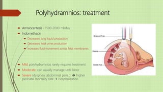 Polyhydramnios: treatment
 Amniocentesis - 1500-2000 ml/day
 Indomethacin
 Decreases lung liquid production
 Decreases fetal urine production
 Increases fluid movement across fetal membranes
 Mild polyhydramnios rarely requires treatment
 Moderate: can usually manage until labor
 Severe (dyspnea, abdominal pain, ):  higher
perinatal mortality rate  hospitalization
 