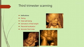 Third trimester scanning
 Indications
 Dating
 Fetal well-being
 Estimation of fetal weight
 Placental localization
 Amniotic fluid index
 