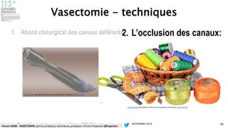 VASECTOMIE| Points juridiques, vasectomie sans bistouri ou conventionnelle, pratiques - Dr Hupertan urologue sexologue