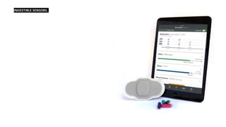 INGESTIBLE SENSORS.
 