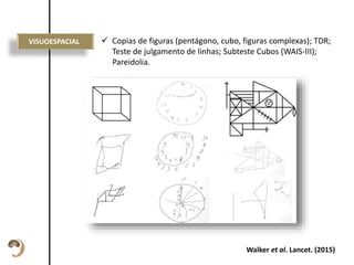 Esta descrição pode
ser um pouco
maior, sem
problemas.
DISTÚRBIO
COMPORTAMENTAL
DO SONO REM
VISUOESPACIAL  Copias de figuras (pentágono, cubo, figuras complexas); TDR;
Teste de julgamento de linhas; Subteste Cubos (WAIS-III);
Pareidolia.
Walker et al. Lancet. (2015)
 