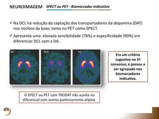 Na DCL há redução da captação dos transportadores da dopamina (DAT)
nos núcleos da base, tanto no PET como SPECT.
Apresenta uma elevada sensibilidade (78%) e especificidade (90%) em
diferenciar DCL com a DA.
NEUROIMAGEM SPECT ou PET - Biomarcador Indicativo
O SPECT ou PET com TRODAT não auxilia no
diferencial com outros parkinsonismo atípico.
Era um critério
sugestivo no 3º
consenso, e passou a
ser agrupado nos
biomarcadores
indicativo.
 