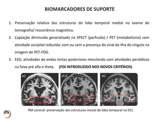 BIOMARCADORES DE SUPORTE
1. Preservação relativa das estruturas do lobo temporal medial no exame de
tomografia/ ressonância magnética.
2. Captação diminuída generalizada no SPECT (perfusão) / PET (metabolismo) com
atividade occipital reduzida; com ou sem a presença do sinal da ilha do cíngulo na
imagem de PET-FDG.
3. EEG: atividades de ondas lentas posteriores mesclando com atividades periódicas
na faixa pré alfa e theta. (FOI INTRODUZIDO NOS NOVOS CRITÉRIOS)
RM coronal: preservação das estruturas mesial do lobo temporal na DCL
 