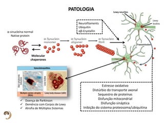 PATOLOGIA
Neurofilaments
Ubiquitin
αβ-Crystallinα-sinucleína normal
Native protein
Molecular
chaperones
Estresse oxidativo
Distúrbio do transporte axonal
Sequestro de proteínas
Disfunção mitocondrial
Disfunção sináptica
Inibição do sistema proteosoma/ubiquitina
 Doença de Parkinson
 Demência com Corpos de Lewy
 Atrofia de Múltiplos Sistemas
 