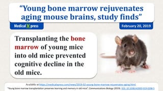 “Young bone marrow rejuvenates
aging mouse brains, study finds”
Microglia in brains of old mice have fewer/shorter branche...