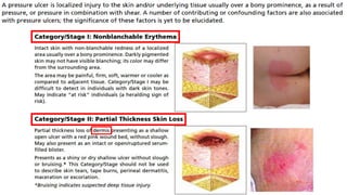 Prevention and Treatment of Pressure Ulcers: Quick Reference Guide | PDF