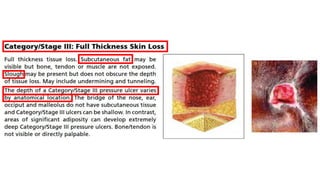 Prevention and Treatment of Pressure Ulcers: Quick Reference Guide | PDF