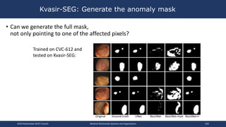 • Can we generate the full mask,
not only pointing to one of the affected pixels?
Kvasir-SEG: Generate the anomaly mask
Trained on CVC-612 and
tested on Kvasir-SEG:
Original Ground truth UNet ResUNet ResUNet-mod ResUNet++
ACM Multimedia 2019 Tutorial Medical Multimedia Systems and Applications 109
 