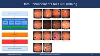 Data Enhancements for CNN Training
ACM Multimedia 2019 Tutorial Medical Multimedia Systems and Applications 112
 