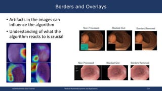 • Artifacts in the images can
influence the algorithm
• Understanding of what the
algorithm reacts to is crucial
Borders and Overlays
ACM Multimedia 2019 Tutorial Medical Multimedia Systems and Applications 114
 