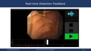 Real-time Detection Feedback
ACM Multimedia 2019 Tutorial Medical Multimedia Systems and Applications 126
 