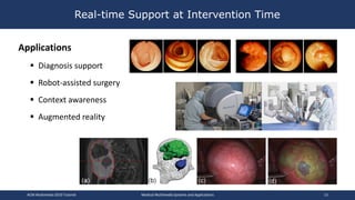 Real-time Support at Intervention Time
Applications
 Diagnosis support
 Robot-assisted surgery
 Context awareness
 Augmented reality
ACM Multimedia 2019 Tutorial Medical Multimedia Systems and Applications 13
 
