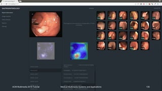 ACM Multimedia 2019 Tutorial Medical Multimedia Systems and Applications 130
 