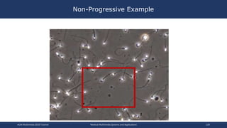 Non-Progressive Example
ACM Multimedia 2019 Tutorial Medical Multimedia Systems and Applications 139
 