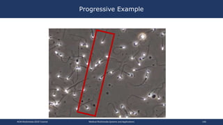 Progressive Example
ACM Multimedia 2019 Tutorial Medical Multimedia Systems and Applications 140
 