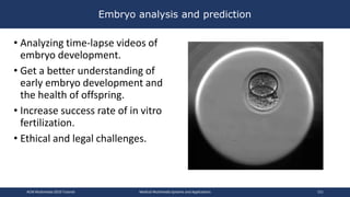 Embryo analysis and prediction
• Analyzing time-lapse videos of
embryo development.
• Get a better understanding of
early embryo development and
the health of offspring.
• Increase success rate of in vitro
fertilization.
• Ethical and legal challenges.
ACM Multimedia 2019 Tutorial Medical Multimedia Systems and Applications 151
 