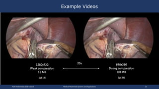 Example Videos
1280x720
Weak compression
16 MB
(crf 18)
640x360
Strong compression
0,8 MB
(crf 26)
20x
ACM Multimedia 2019 Tutorial Medical Multimedia Systems and Applications 23
 