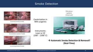 Smoke Detection
ACM Multimedia 2019 Tutorial Medical Multimedia Systems and Applications 29
Cauterization in
90% surgeries
Instruments:
Laser or HF
(100° - 1200° C)
filtration
system
(manual)
 Automatic Smoke Detection & Removal?
(Real-Time)
 
