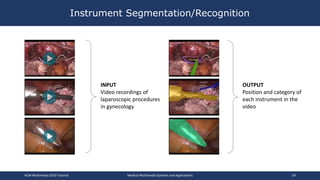 Instrument Segmentation/Recognition
ACM Multimedia 2019 Tutorial Medical Multimedia Systems and Applications 39
INPUT
Video recordings of
laparoscopic procedures
in gynecology
OUTPUT
Position and category of
each instrument in the
video
 