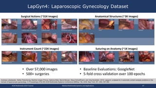 LapGyn4: Laparoscopic Gynecology Dataset
ACM Multimedia 2019 Tutorial Medical Multimedia Systems and Applications 47
Surgical Actions (~31K images) Anatomical Structures (~3K images)
Andreas Leibetseder, Stefan Petscharnig, Manfred Jürgen Primus, Sabrina Kletz, Bernd Münzer, Klaus Schoeffmann, and Jörg Keckstein. 2018. Lapgyn4: a dataset for 4 automatic content analysis problems in the
domain of laparoscopic gynecology. In Proceedings of the 9th ACM Multimedia Systems Conference (MMSys '18). ACM, New York, NY, USA, 357-362.
Instrument Count (~22K images) Suturing on Anatomy (~1K images)
• Over 57,000 images
• 500+ surgeries
• Baseline Evaluations: GoogleNet
• 5-fold cross validation over 100 epochs
 