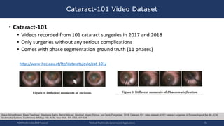 • Cataract-101
• Videos recorded from 101 cataract surgeries in 2017 and 2018
• Only surgeries without any serious complications
• Comes with phase segmentation ground truth (11 phases)
Cataract-101 Video Dataset
ACM Multimedia 2019 Tutorial Medical Multimedia Systems and Applications 51
Klaus Schoeffmann, Mario Taschwer, Stephanie Sarny, Bernd Münzer, Manfred Jürgen Primus, and Doris Putzgruber. 2018. Cataract-101: video dataset of 101 cataract surgeries. In Proceedings of the 9th ACM
Multimedia Systems Conference (MMSys '18). ACM, New York, NY, USA, 421-425.
http://www-itec.aau.at/ftp/datasets/ovid/cat-101/
 