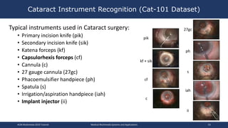Typical instruments used in Cataract surgery:
• Primary incision knife (pik)
• Secondary incision knife (sik)
• Katena forceps (kf)
• Capsulorhexis forceps (cf)
• Cannula (c)
• 27 gauge cannula (27gc)
• Phacoemulsifier handpiece (ph)
• Spatula (s)
• Irrigation/aspiration handpiece (iah)
• Implant injector (ii)
Cataract Instrument Recognition (Cat-101 Dataset)
ACM Multimedia 2019 Tutorial Medical Multimedia Systems and Applications 53
pik
kf + sik
cf
c
27gc
ph
s
iah
ii
 