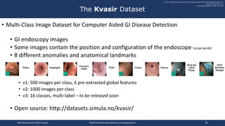 • Multi-Class Image Dataset for Computer Aided GI Disease Detection
• GI endoscopy images
• Some images contain the position and configuration of the endoscope (scope guide)
• 8 different anomalies and anatomical landmarks
• v1: 500 images per class, 6 pre-extracted global features
• v2: 1000 images per class
• v3: 16 classes, multi-label – to be released soon
• Open source: http://datasets.simula.no/kvasir/
The Kvasir Dataset
"Kvasir: A Multi-Class Image-Dataset for Computer Aided Gastrointestinal Disease Detection"
Konstantin Pogorelov, et al.
Proceedings of MMSYS, Taiwan, June 2017
ACM Multimedia 2019 Tutorial Medical Multimedia Systems and Applications 81
 