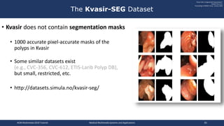 • Kvasir does not contain segmentation masks
• 1000 accurate pixel-accurate masks of the
polyps in Kvasir
• Some similar datasets exist
(e.g., CVC-356, CVC-612, ETIS-Larib Polyp DB),
but small, restricted, etc.
• http://datasets.simula.no/kvasir-seg/
The Kvasir-SEG Dataset
”Kvasir-SEG: A Segmented Polyp Dataset"
Debesh Jha, et al.
Proceedings of MMM, Korea, January 2020
ACM Multimedia 2019 Tutorial Medical Multimedia Systems and Applications 83
 