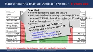 State-of-The-Art: Example Detection Systems – 5 years ago
Polyp-Alert
• detects polyps using edges and texture
• near real-time feedback during colonoscopy (10fps)
• detected 97.7% (42 of 43) of polyp shots on 53 randomly selected
(not per frame detection)
• one of the few end-to-end systems
• Wallapak Tavanapong – from MM community
100s of new approaches the last years, many with good detection results…
ACM Multimedia 2019 Tutorial Medical Multimedia Systems and Applications 86
 